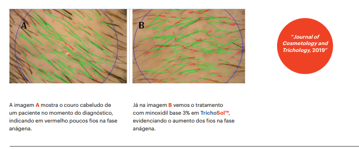 Trichosol estimulo fase anagena