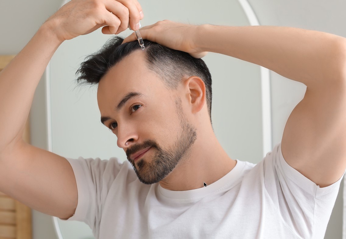 flutaminda-locao-topica-combate-AAG-calvicie-alopecia