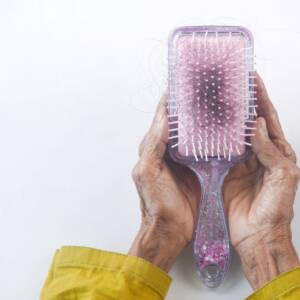 Escova com fios de cabelo, ilustrando shedding e aumento temporário da queda capilar